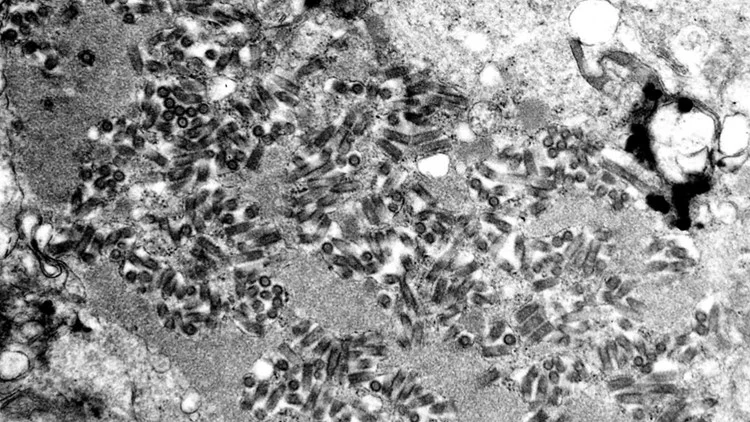 Boy, 11, dies of rabies after bat encounter during...